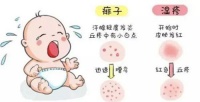 婴儿热疹怎么处理 宝宝为什么会起热疹