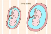 胎儿在几个月容易畸形 怀孕一个月吃什么好