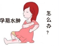 孕晚期水肿怎么缓解 怀孕后期水肿的原因有哪些